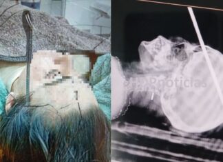 Una mujer le clavó un hierro en la cabeza a otra en San Martín