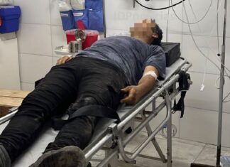 Le cayó un rayo en Puerto Vilelas y sobrevivió