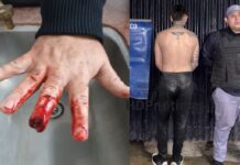 Barber fuera de sí golpeó a su padre y le mordió un dedo a un policía
