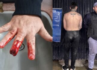 Barber fuera de sí golpeó a su padre y le mordió un dedo a un policía