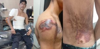 Cayó el ladrón que robó cables a Sameep: pidió auxilio en el Perrando